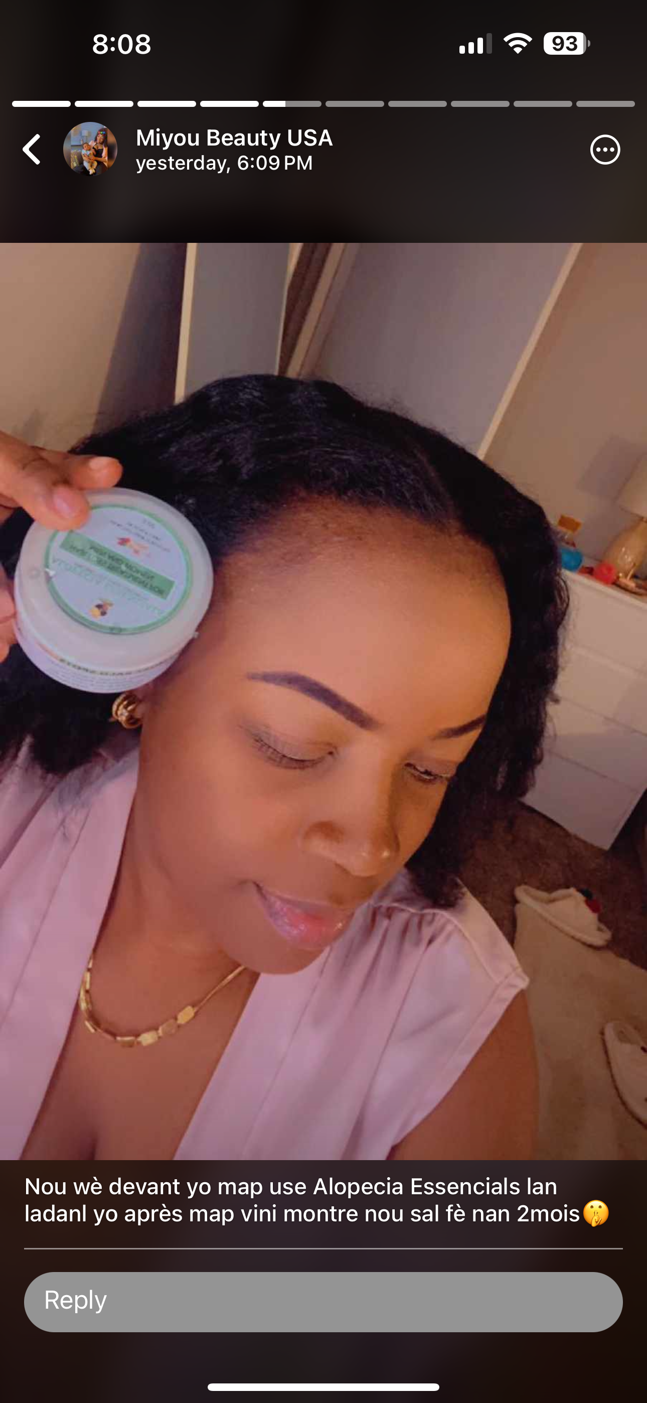 ALOPECIA ESSENTIALS ( Regrowth your edges)
