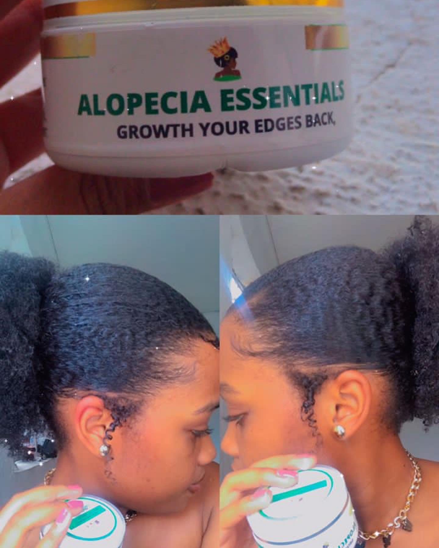 ALOPECIA ESSENTIALS ( Regrowth your edges)